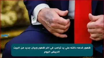 ظهور كدمة داكنة على يد ترامب في آخر ظهور وبيان جديد من البيت الأبيض اليوم